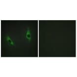 Immunofluorescence - Anti-LAMB3 Antibody (C13071) - Antibodies.com