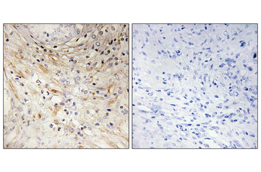Immunohistochemistry - Anti-LAMB3 Antibody (C13071) - Antibodies.com