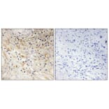 Immunohistochemistry - Anti-LAMB3 Antibody (C13071) - Antibodies.com