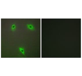Immunofluorescence - Anti-KLHL3 Antibody (C11840) - Antibodies.com