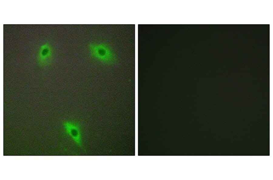 Immunofluorescence - Anti-KLHL3 Antibody (C11840) - Antibodies.com