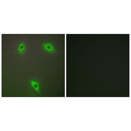Immunofluorescence - Anti-KLHL3 Antibody (C11840) - Antibodies.com