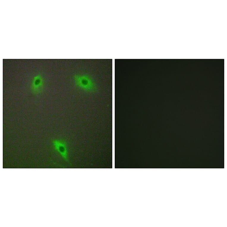 Immunofluorescence - Anti-KLHL3 Antibody (C11840) - Antibodies.com