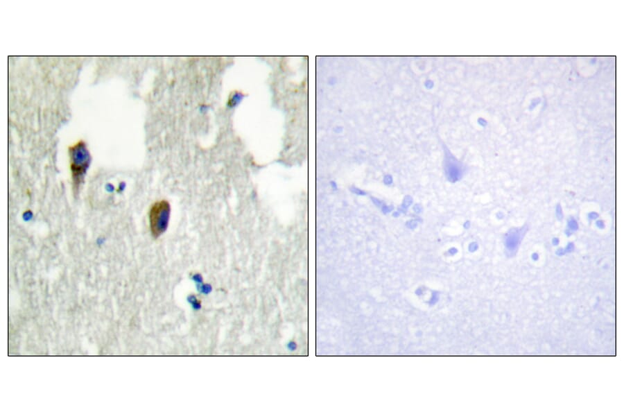 Immunohistochemistry - Anti-KLHL3 Antibody (C11840) - Antibodies.com
