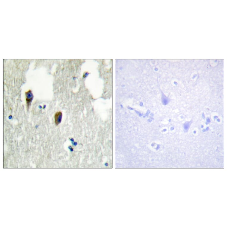 Immunohistochemistry - Anti-KLHL3 Antibody (C11840) - Antibodies.com