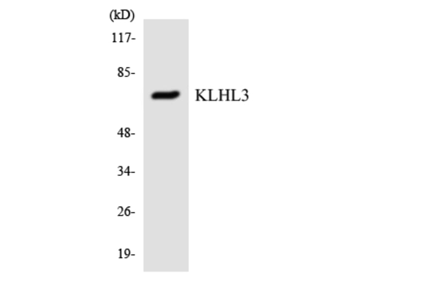 Western Blot - Anti-KLHL3 Antibody (R12-2956) - Antibodies.com