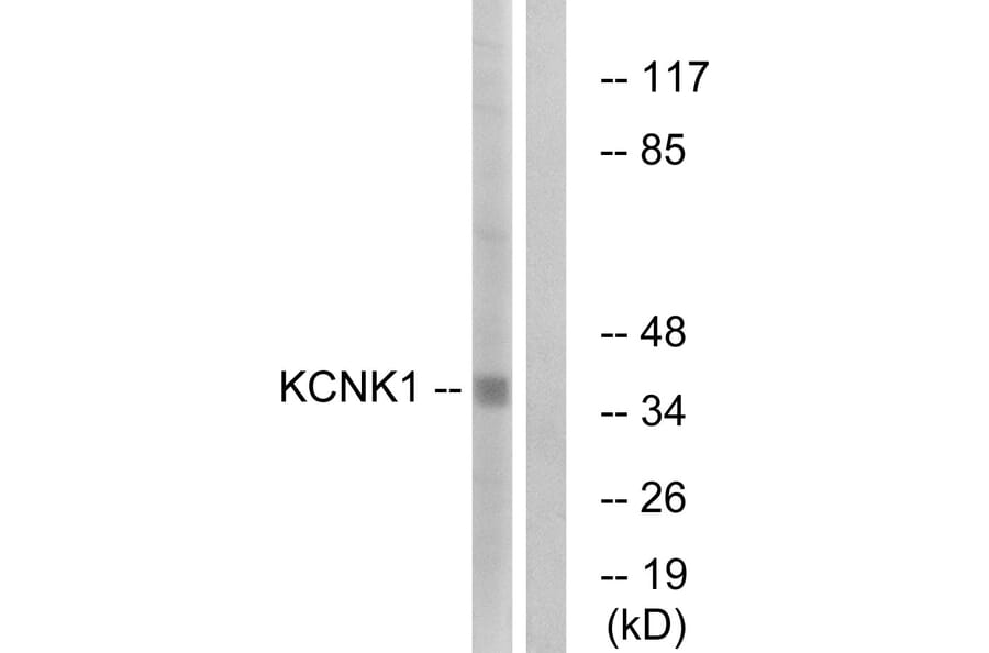 Western Blot - Anti-KCNK1 Antibody (C17775) - Antibodies.com