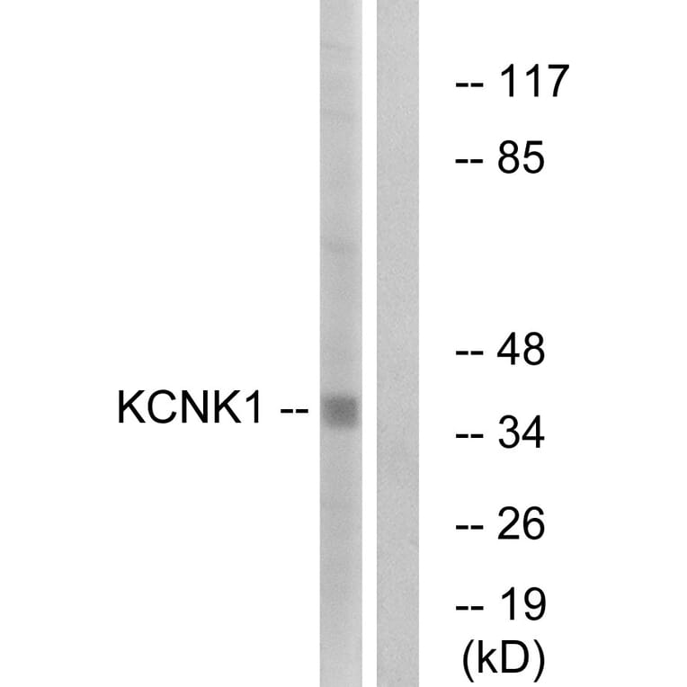 Western Blot - Anti-KCNK1 Antibody (C17775) - Antibodies.com