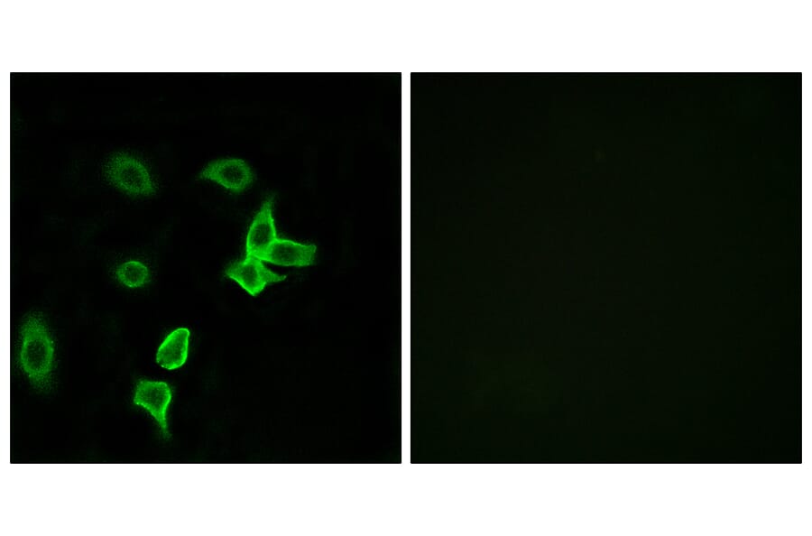 Immunofluorescence - Anti-KANK2 Antibody (C14496) - Antibodies.com