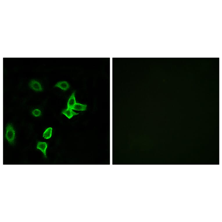 Immunofluorescence - Anti-KANK2 Antibody (C14496) - Antibodies.com