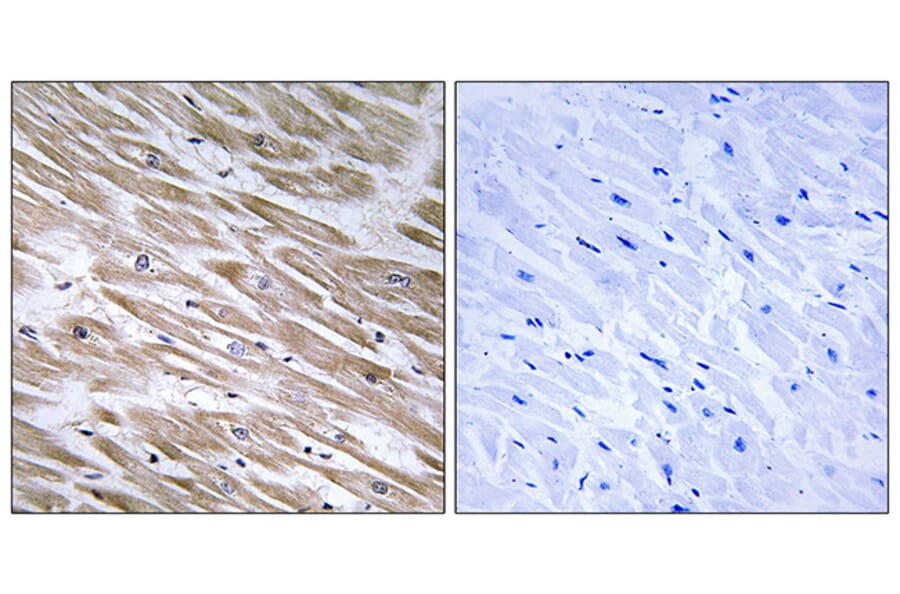 Immunohistochemistry - Anti-KANK2 Antibody (C14496) - Antibodies.com