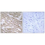 Immunohistochemistry - Anti-KANK2 Antibody (C14496) - Antibodies.com