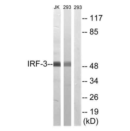 Western Blot - Anti-IRF-3 Antibody (B8203) - Antibodies.com
