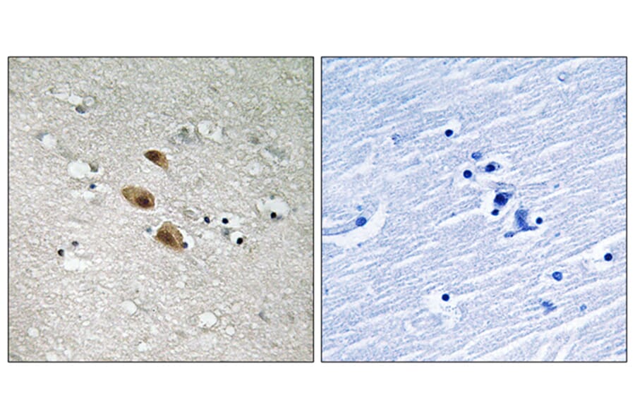 Immunohistochemistry - Anti-IRF-3 Antibody (B8203) - Antibodies.com