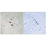 Immunohistochemistry - Anti-IRF-3 Antibody (B8203) - Antibodies.com