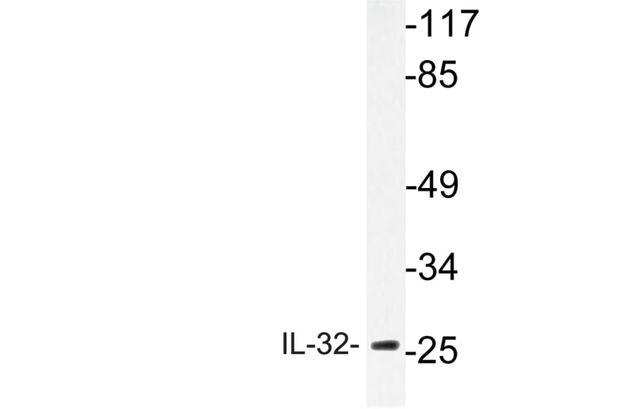 Western Blot - Anti-IL-32 Antibody (R12-2209) - Antibodies.com