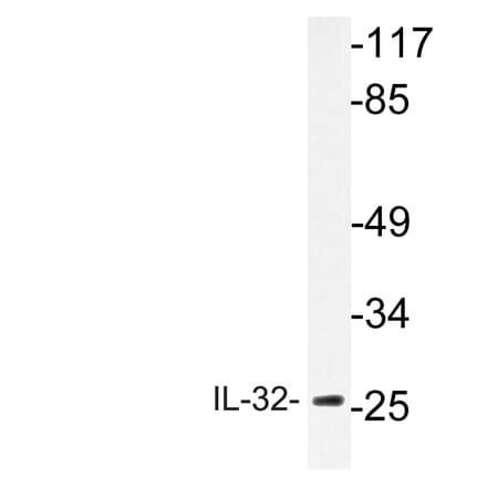 Western Blot - Anti-IL-32 Antibody (R12-2209) - Antibodies.com