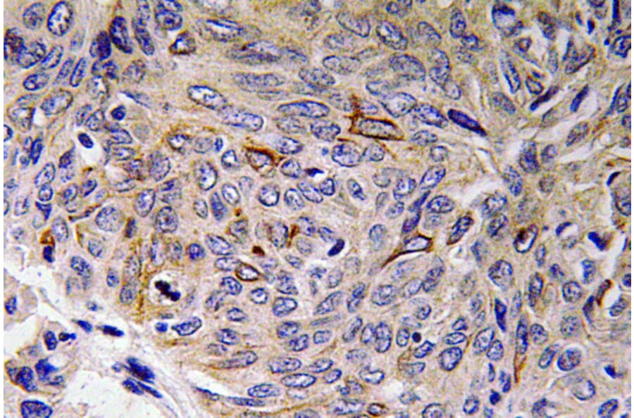 Immunohistochemistry - Anti-IL-32 Antibody (R12-2209) - Antibodies.com