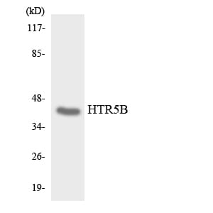 Western blot analysis of the lysates from HepG2 cells using Anti-HTR5B Antibody.