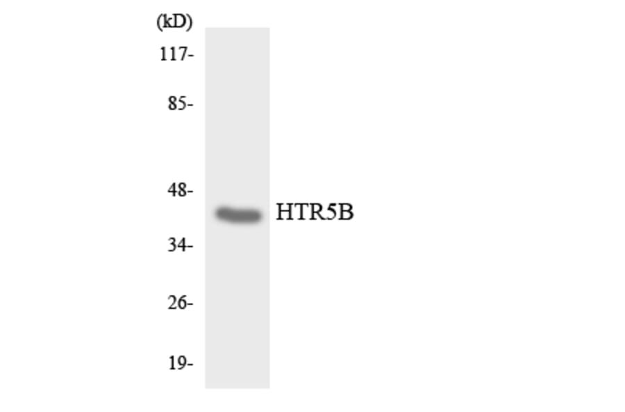 Western Blot - Anti-HTR5B Antibody (R12-2905) - Antibodies.com