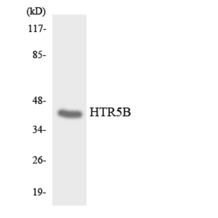 Western Blot - Anti-HTR5B Antibody (R12-2905) - Antibodies.com