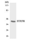 Western Blot - Anti-HTR5B Antibody (R12-2905) - Antibodies.com