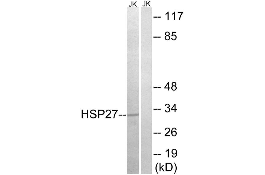 Western Blot - Anti-HSP27 Antibody (B7111) - Antibodies.com