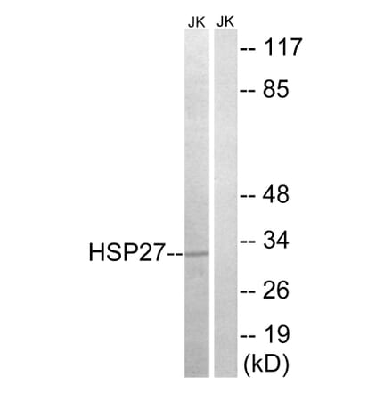 Western Blot - Anti-HSP27 Antibody (B7111) - Antibodies.com