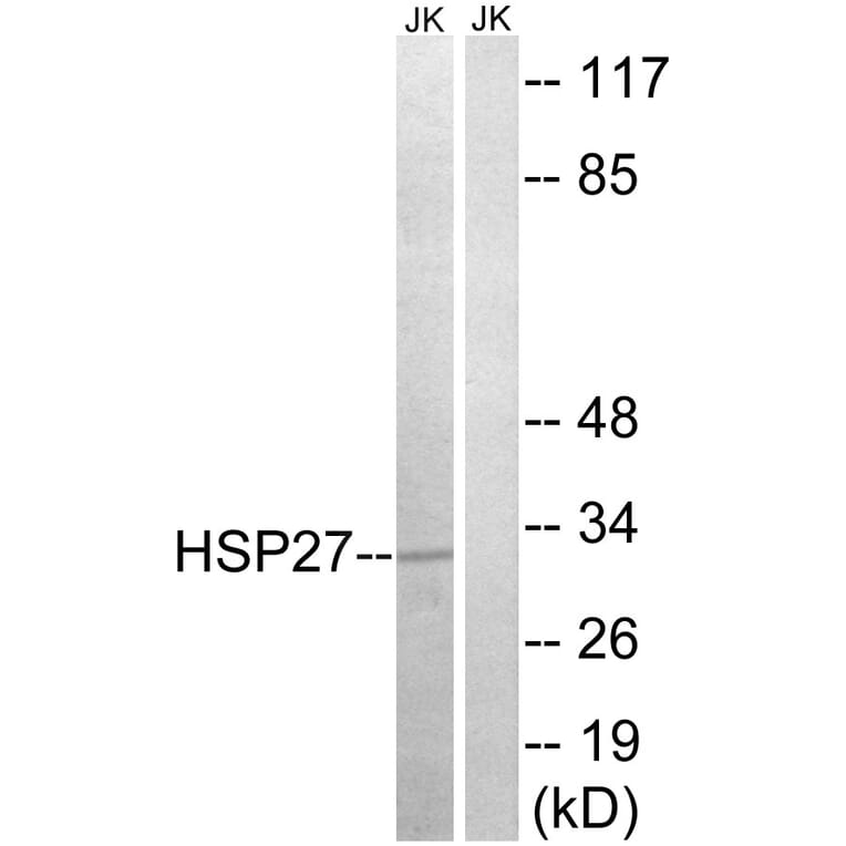 Western Blot - Anti-HSP27 Antibody (B7111) - Antibodies.com