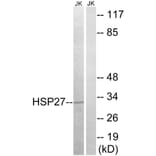 Western Blot - Anti-HSP27 Antibody (B7111) - Antibodies.com