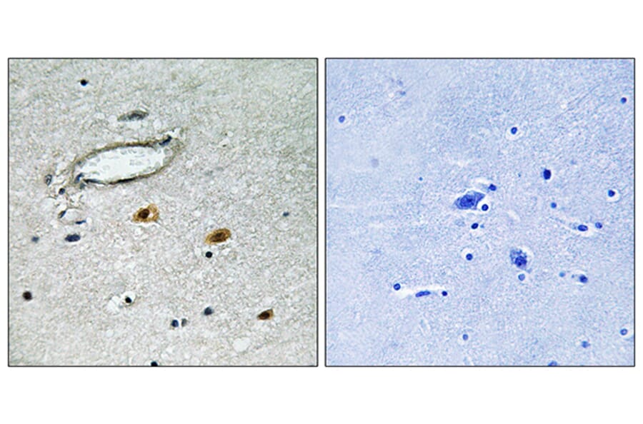 Immunohistochemistry - Anti-HSP27 Antibody (B7111) - Antibodies.com