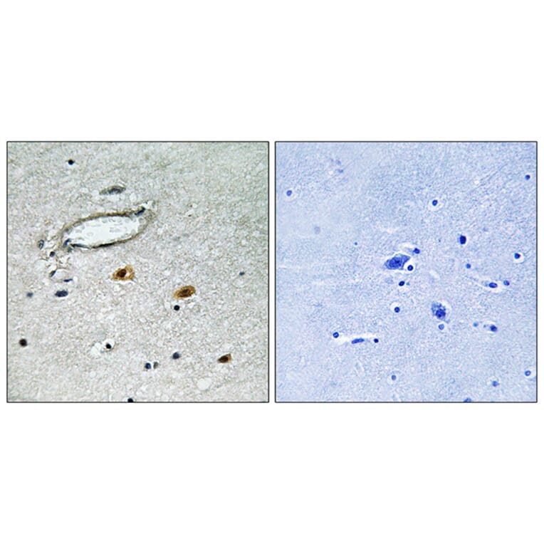 Immunohistochemistry - Anti-HSP27 Antibody (B7111) - Antibodies.com