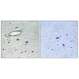 Immunohistochemistry - Anti-HSP27 Antibody (B7111) - Antibodies.com