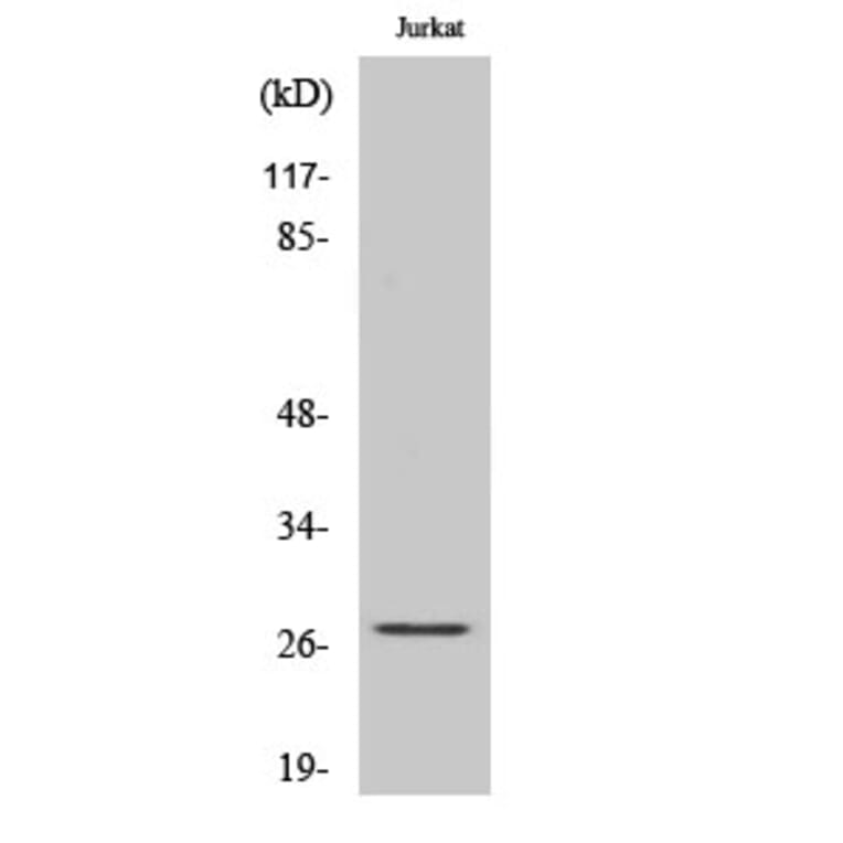 Western Blot - Anti-HSP27 Antibody (B7111) - Antibodies.com