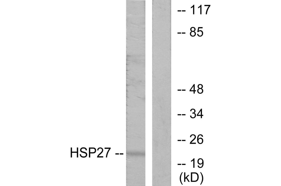 Western Blot - Anti-HSP27 Antibody (B7110) - Antibodies.com