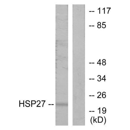Western Blot - Anti-HSP27 Antibody (B7110) - Antibodies.com