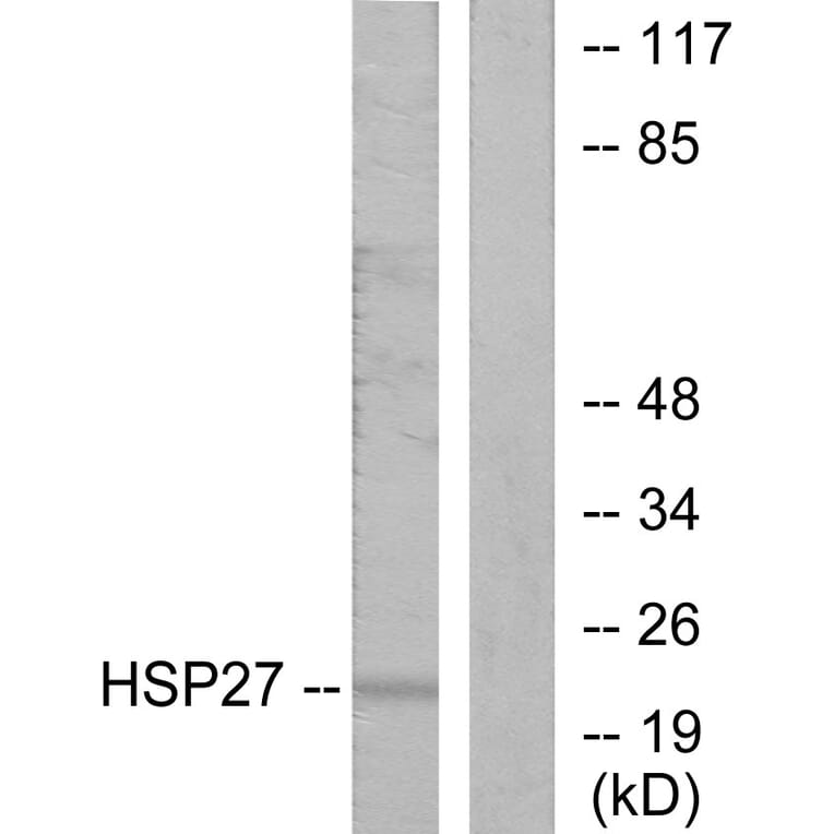 Western Blot - Anti-HSP27 Antibody (B7110) - Antibodies.com