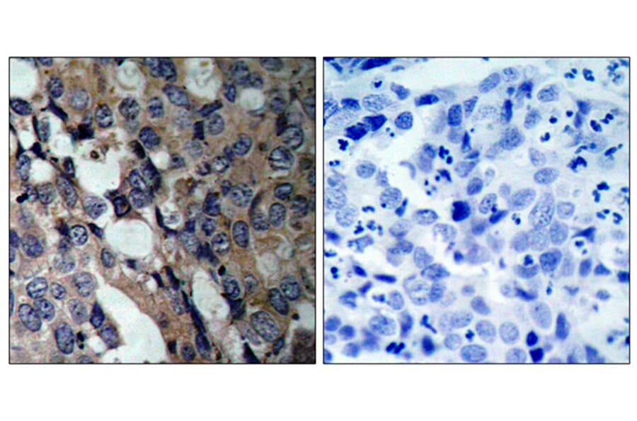Immunohistochemistry - Anti-HSP27 Antibody (B7110) - Antibodies.com