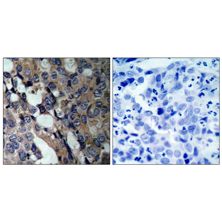 Immunohistochemistry - Anti-HSP27 Antibody (B7110) - Antibodies.com