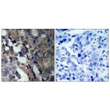 Immunohistochemistry - Anti-HSP27 Antibody (B7110) - Antibodies.com