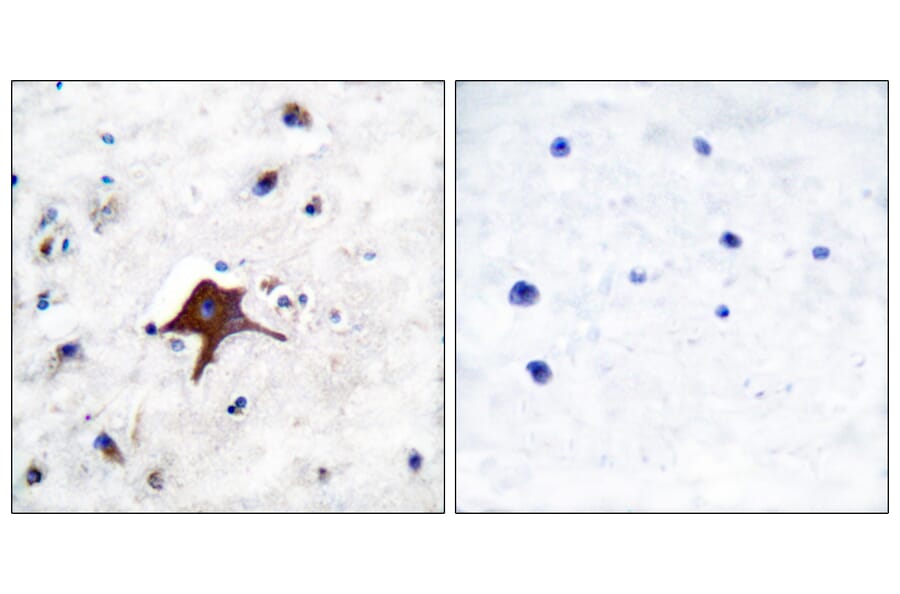 Immunohistochemistry - Anti-GLUT3 Antibody (C0214) - Antibodies.com