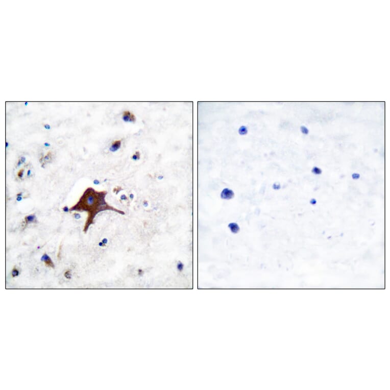 Immunohistochemistry - Anti-GLUT3 Antibody (C0214) - Antibodies.com