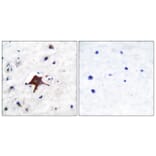 Immunohistochemistry - Anti-GLUT3 Antibody (C0214) - Antibodies.com