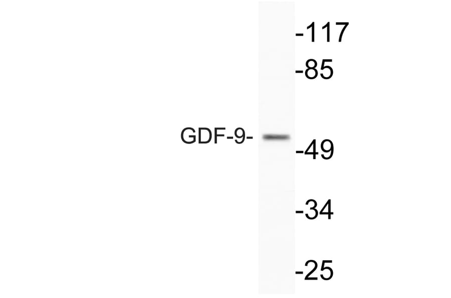 Western Blot - Anti-GDF-9 Antibody (R12-2162) - Antibodies.com