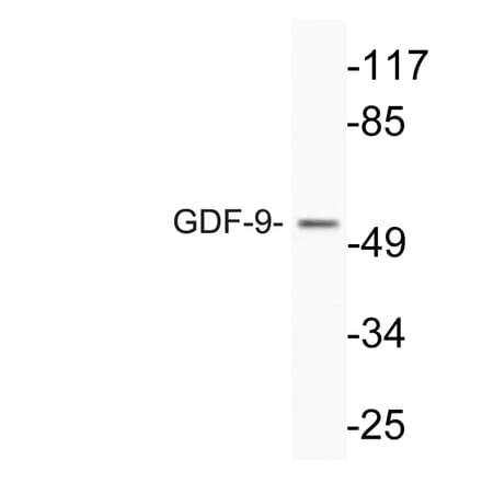 Western Blot - Anti-GDF-9 Antibody (R12-2162) - Antibodies.com