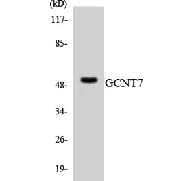 Western Blot - Anti-GCNT7 Antibody (R12-2805) - Antibodies.com