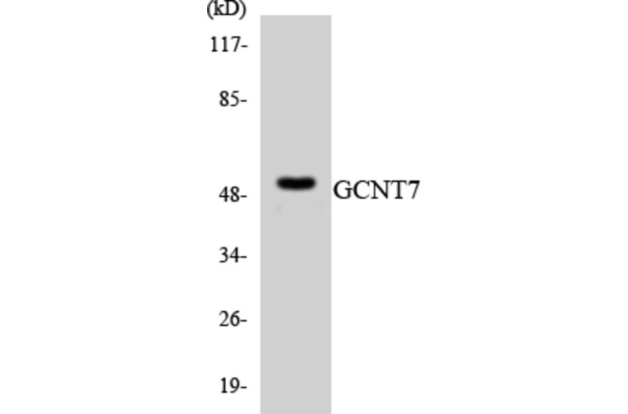 Western Blot - Anti-GCNT7 Antibody (R12-2805) - Antibodies.com