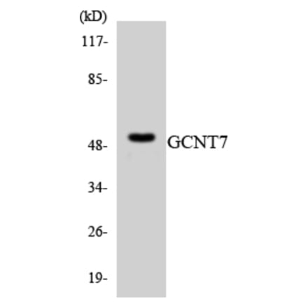 Western Blot - Anti-GCNT7 Antibody (R12-2805) - Antibodies.com
