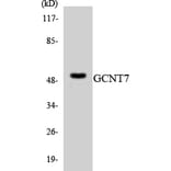 Western Blot - Anti-GCNT7 Antibody (R12-2805) - Antibodies.com