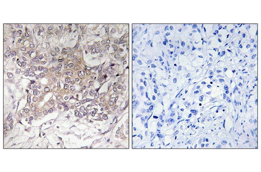 Immunohistochemistry - Anti-GCNT3 Antibody (C14708) - Antibodies.com